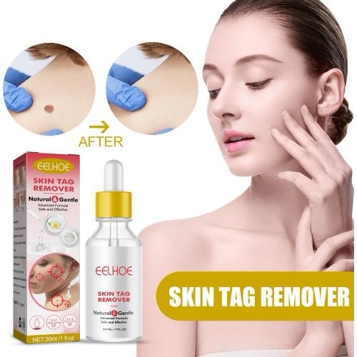 30 ml/bouteille Anti-taupe et verrue liquide dissolvant d'étiquette de tache foncée Essence de peau - Wakeshopes